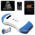 Escáner de ultrasonido inalámbrico de punto de cuidado